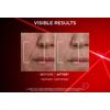 L'Oréal Paris Revitalift Laser Day Cream - 50 ml