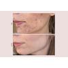 Pudderdåserne T-Zone Peeling - 50 ml