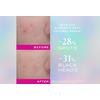 Nuxe Zinc Power Blemish And Spot Control Serum - 30 ml