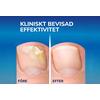 Scholl Nagelsvampsbehandling