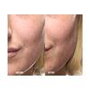 Grown Alchemist Skin Renewal Serum - 25 ml