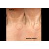 The Inkey Bio-Active Ceramide Neck Lift Stick - 20 g