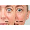 The Inkey Bio-Active Ceramide Eye Cream - 18 ml