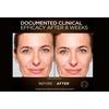 L'Oréal Paris Age Perfect Cell Renewal Midnight Serum - 30 ml