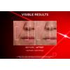 L'Oréal Paris Revitalift Laser Day Cream - 50 ml
