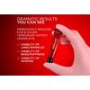 L'Oréal Paris Revitalift Laser Eye Bag Eraser - 15 ml